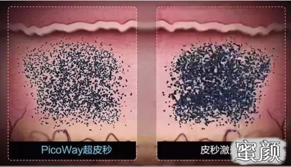 案例图片