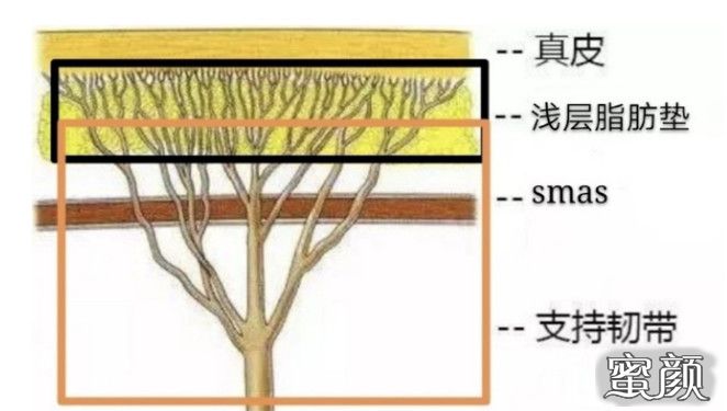 案例图片