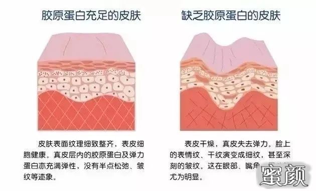 https://img.yiyiaimei.com/mnt/timg/210102/205032A42-1.jpg
