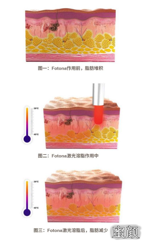 案例图片