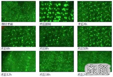 案例图片