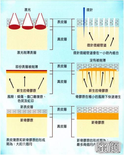 案例图片