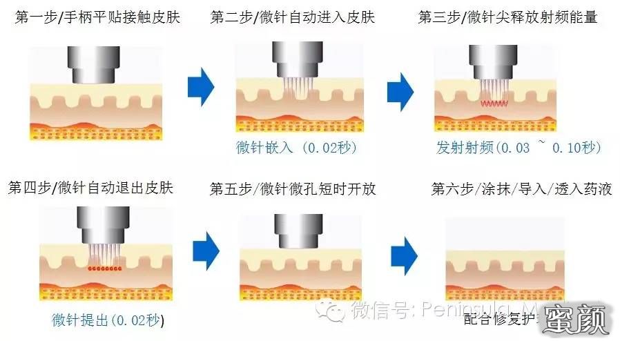 案例图片