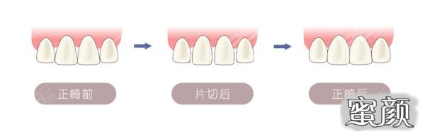 案例图片