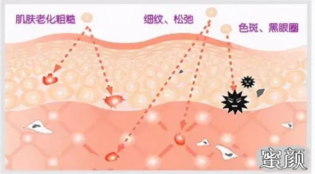 https://img.yiyiaimei.com/mnt/timg/210106/164H3B40-6.jpg