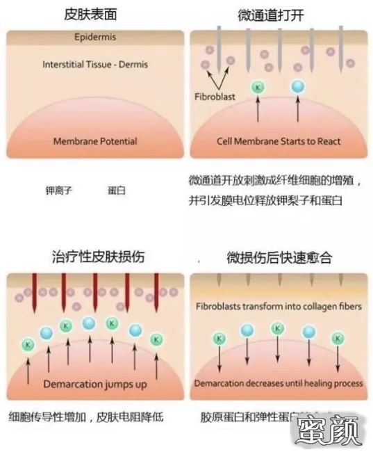 案例图片