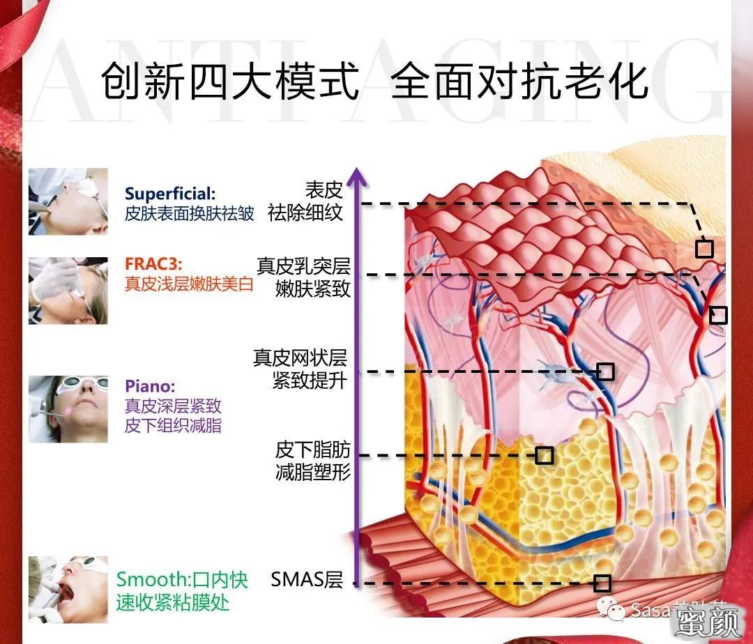 案例图片