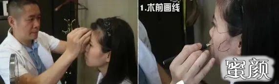 案例图片
