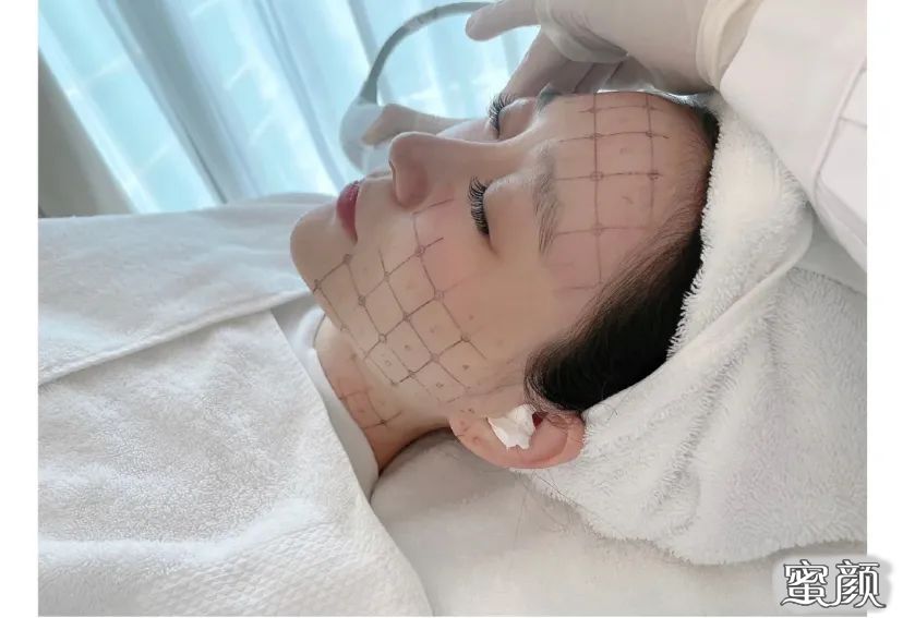 案例图片