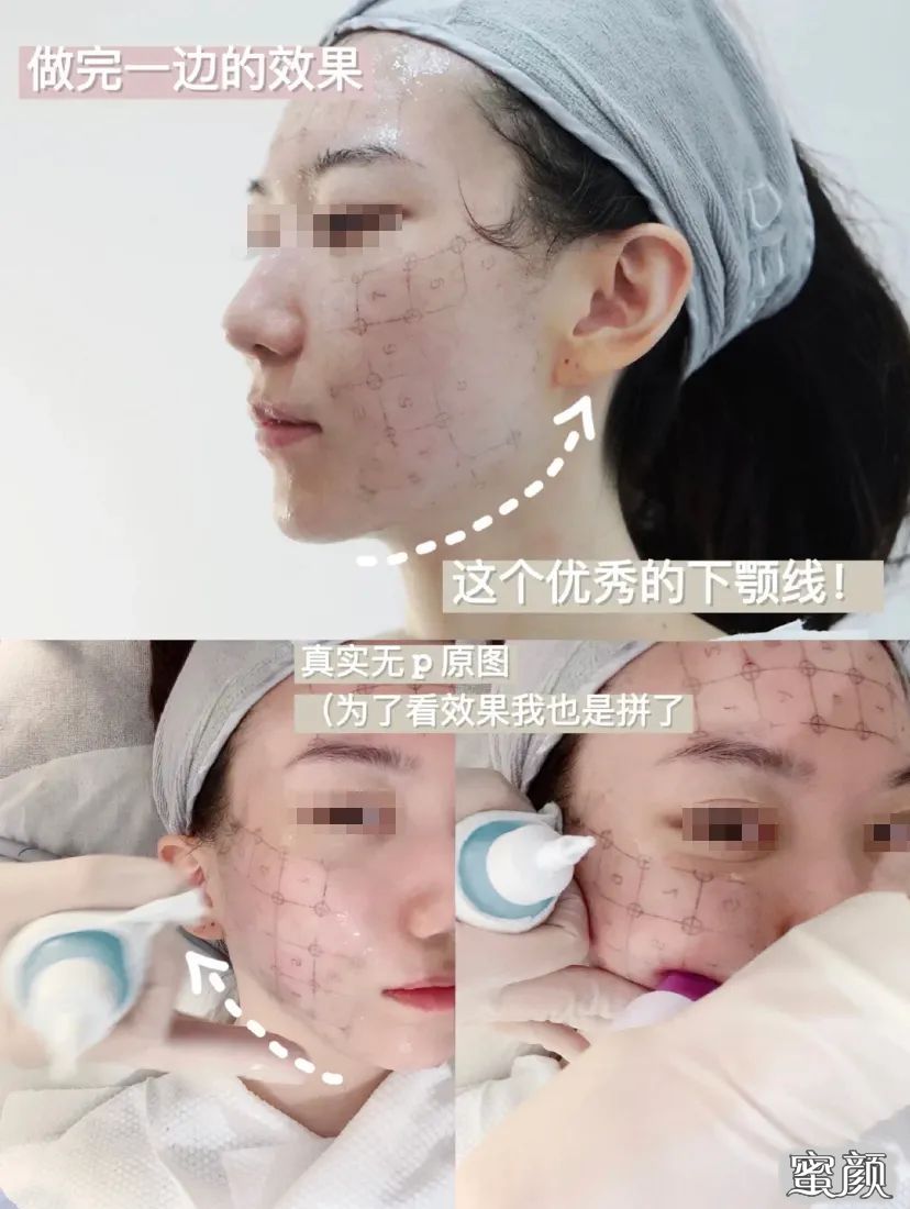 案例图片