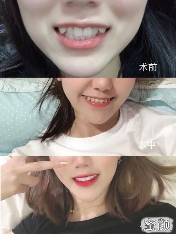案例图片