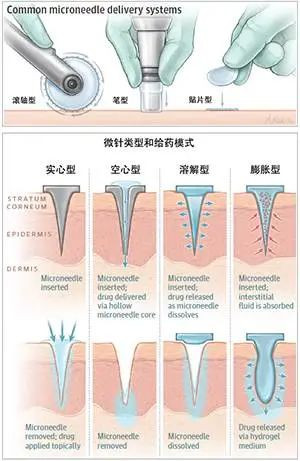 案例图片