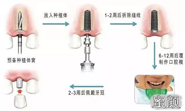 案例图片