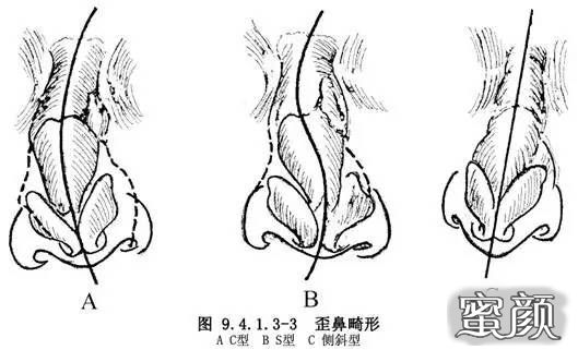 案例图片