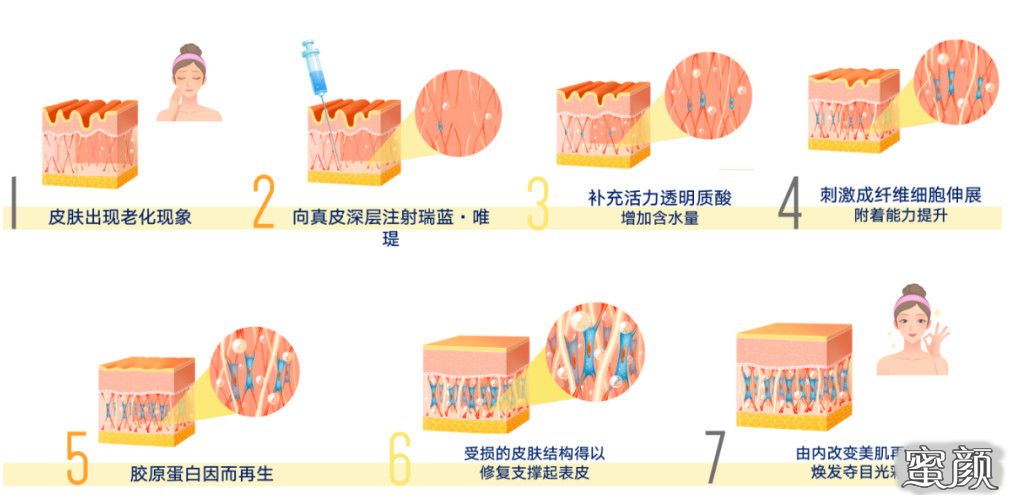 案例图片