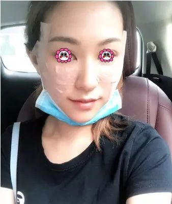 案例图片