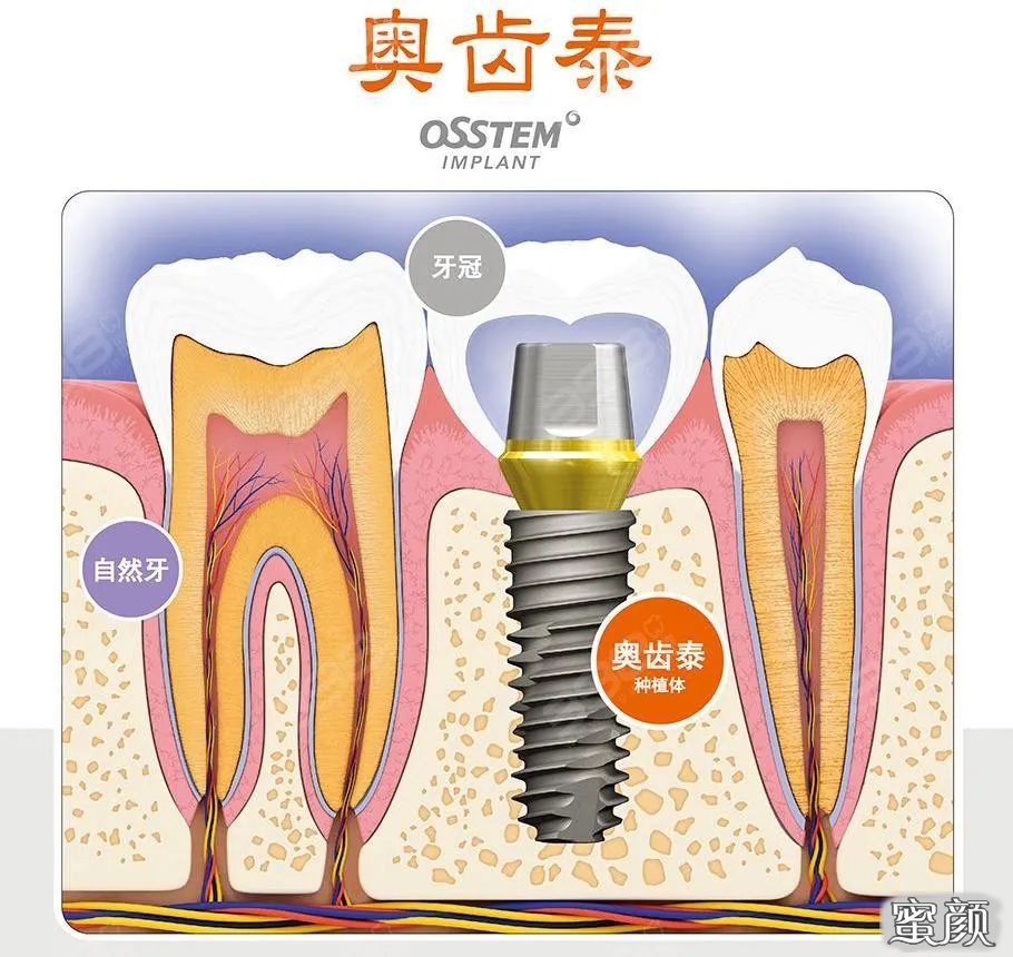 案例图片