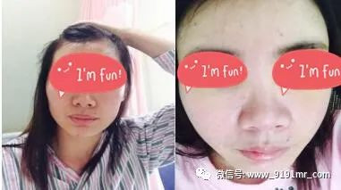 案例图片