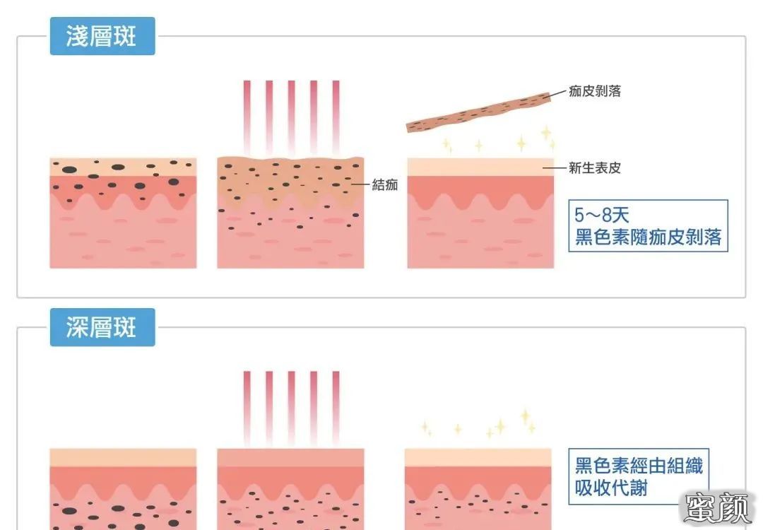 案例图片