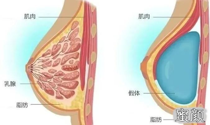 案例图片