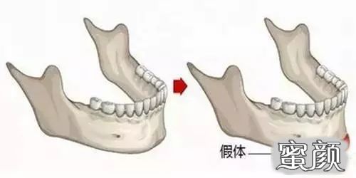 案例图片