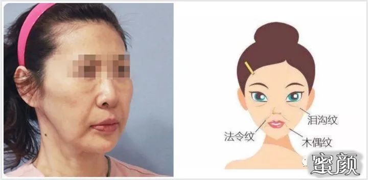 https://img.yiyiaimei.com/mnt/timg/210111/1603051360-3.jpg