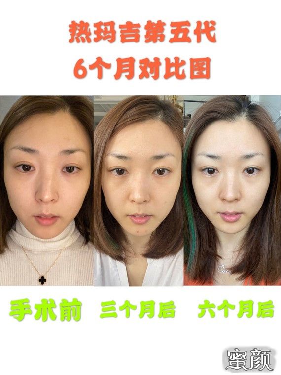 https://img.yiyiaimei.com/mnt/timg/210111/160305E24-2.jpg