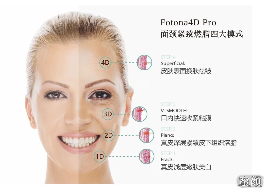 https://img.yiyiaimei.com/mnt/timg/210111/1604044R0-1.jpg