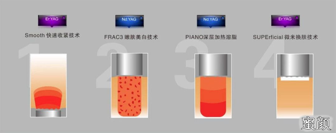 https://img.yiyiaimei.com/mnt/timg/210111/1604124918-5.jpg