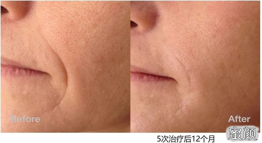 https://img.yiyiaimei.com/mnt/timg/210111/16041W255-7.jpg
