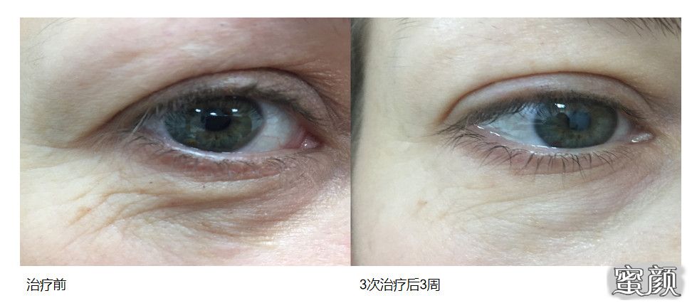 https://img.yiyiaimei.com/mnt/timg/210111/1604225428-8.jpg