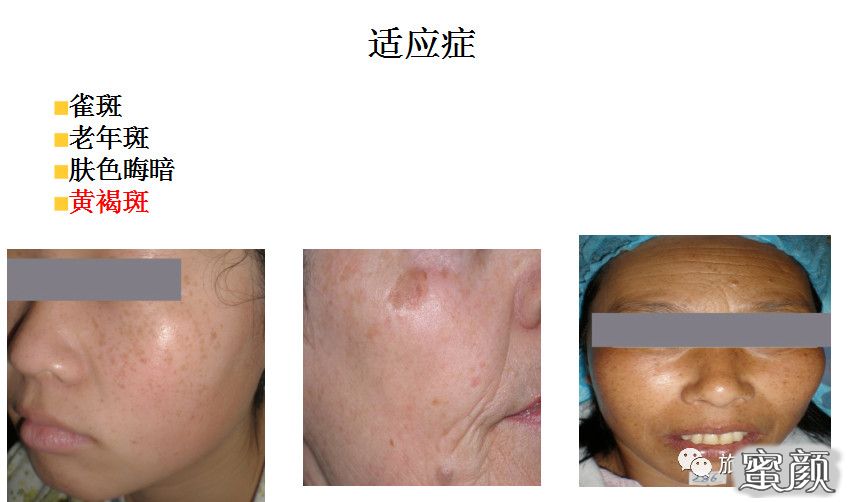 https://img.yiyiaimei.com/mnt/timg/210111/164Q93508-6.jpg