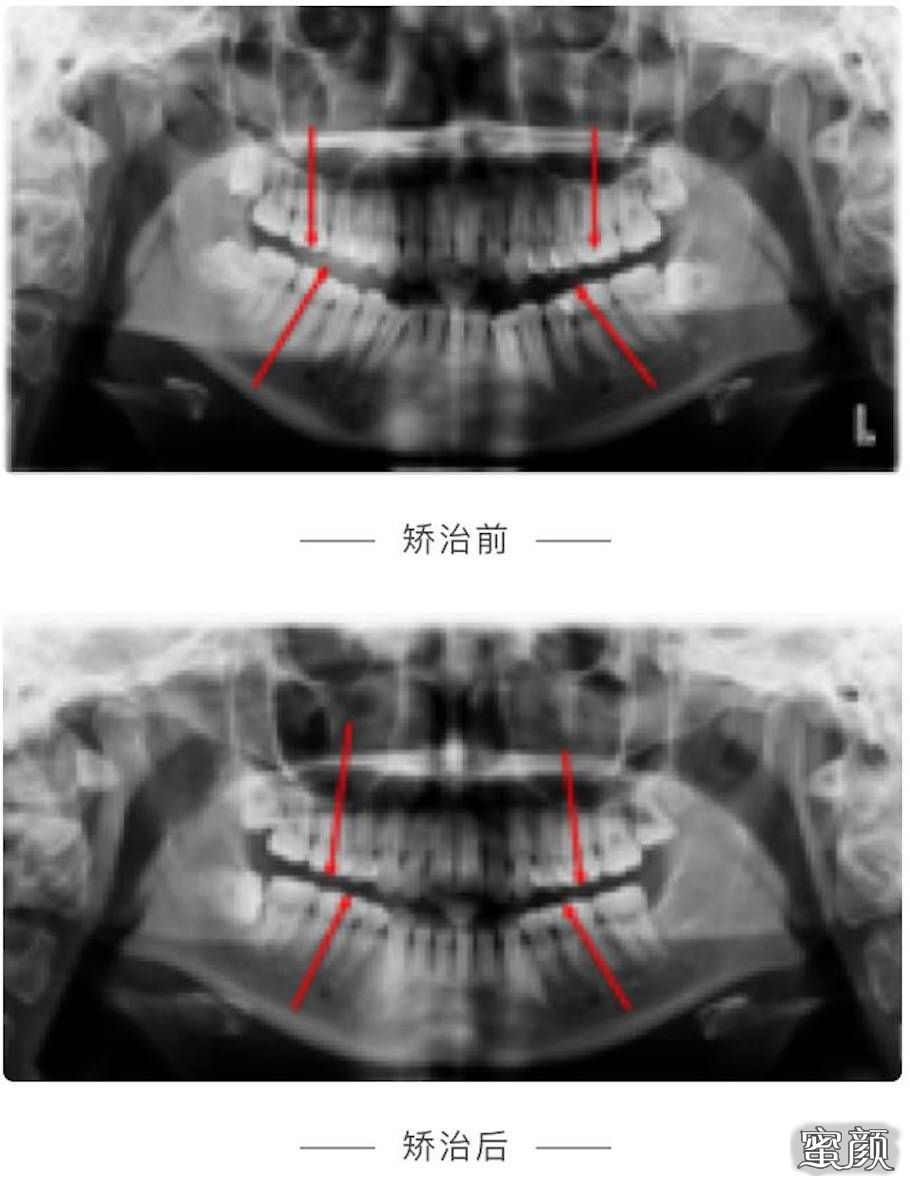 案例图片