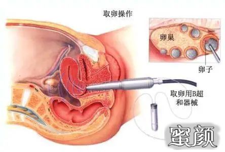 https://img.yiyiaimei.com/mnt/timg/210111/2210542C8-3.jpg