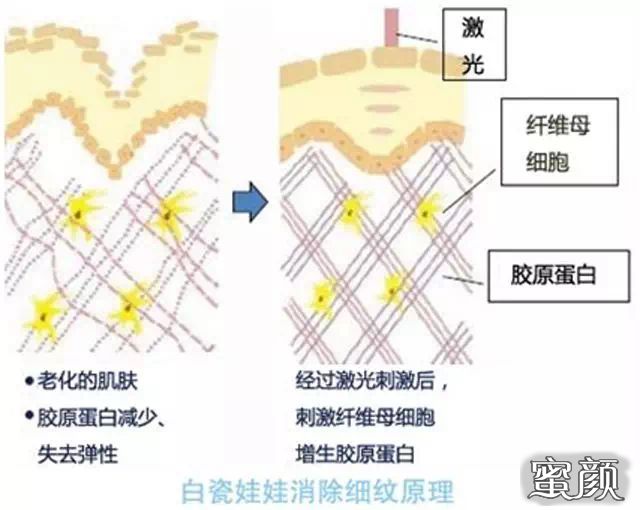 案例图片