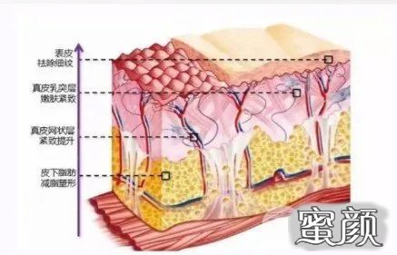 案例图片