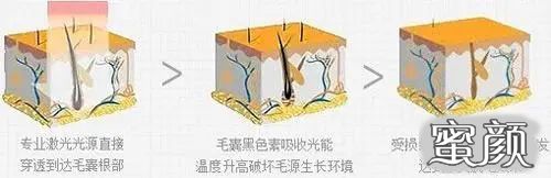 案例图片