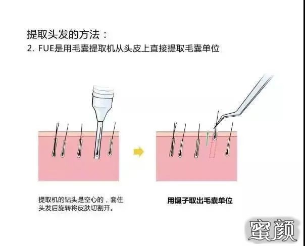 案例图片