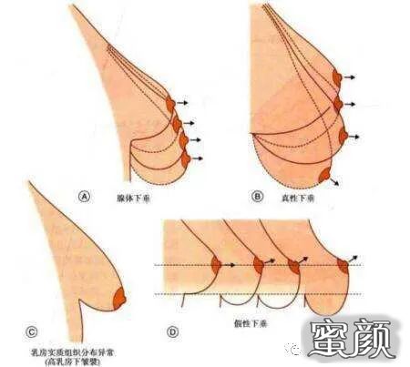 案例图片