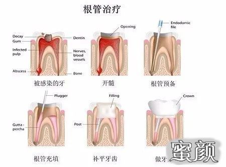 案例图片