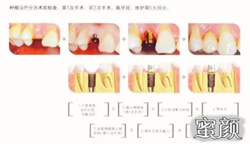 案例图片