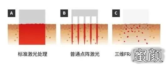 案例图片