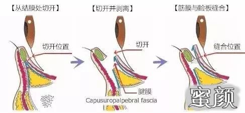 案例图片