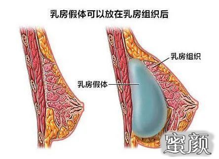 案例图片