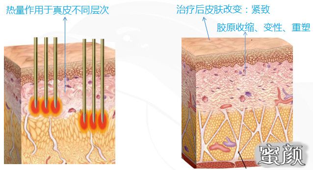 案例图片