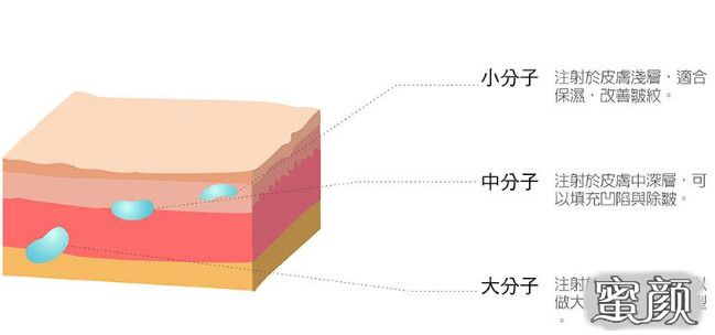 案例图片