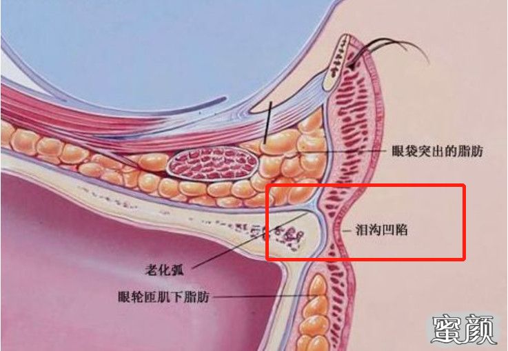 案例图片