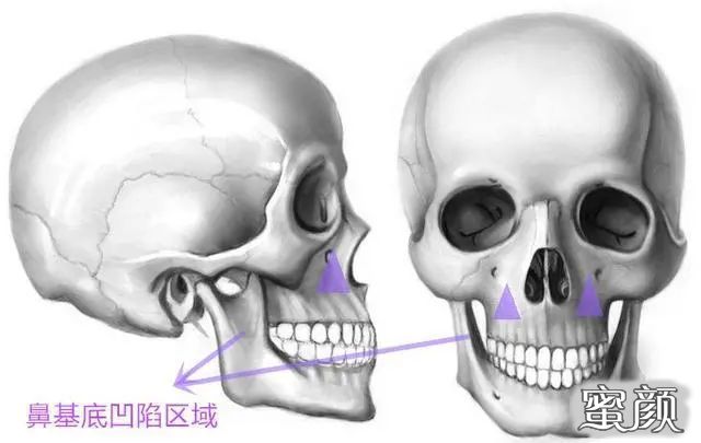 案例图片