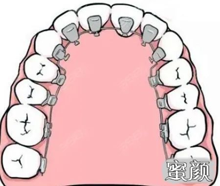 案例图片