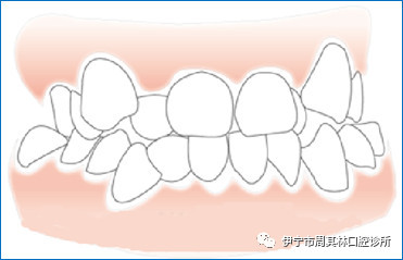 案例图片